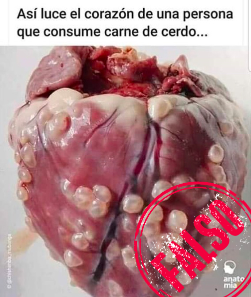 cisticercosis signos